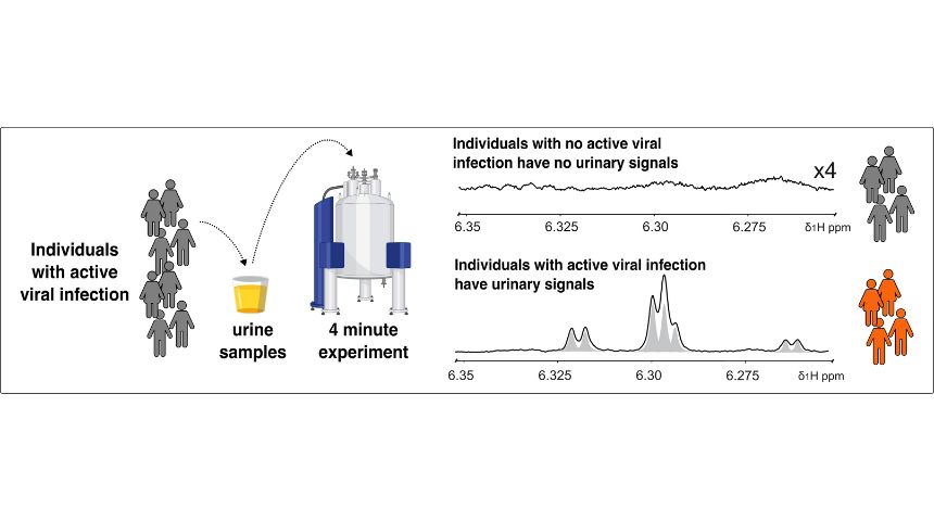 Graphic showing an individual with a suspected infection be screened within minutes by simply providing a urine sample. .