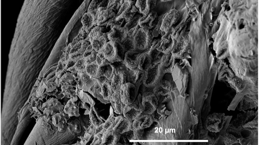 Experimental fabrics observed with a ‘scanning electron microscope’ (SEM) showed fungal colonisation. Photo by Stevie Ziogos.